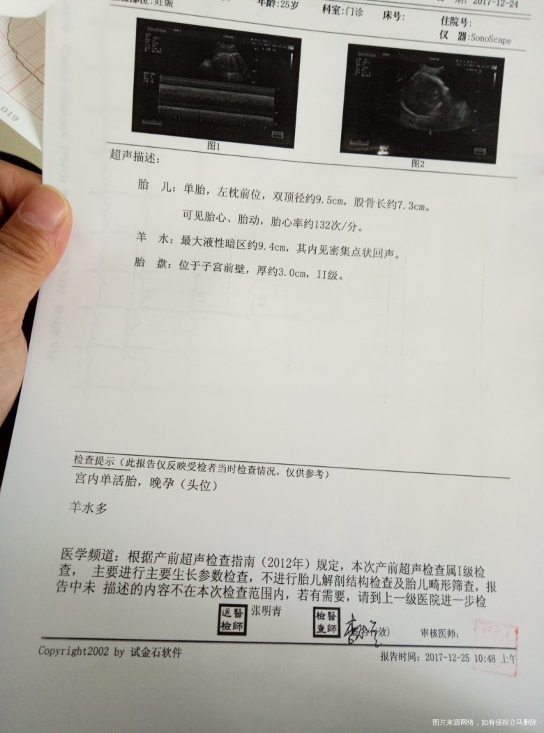 急!!!!!有医生在吗?帮我看看