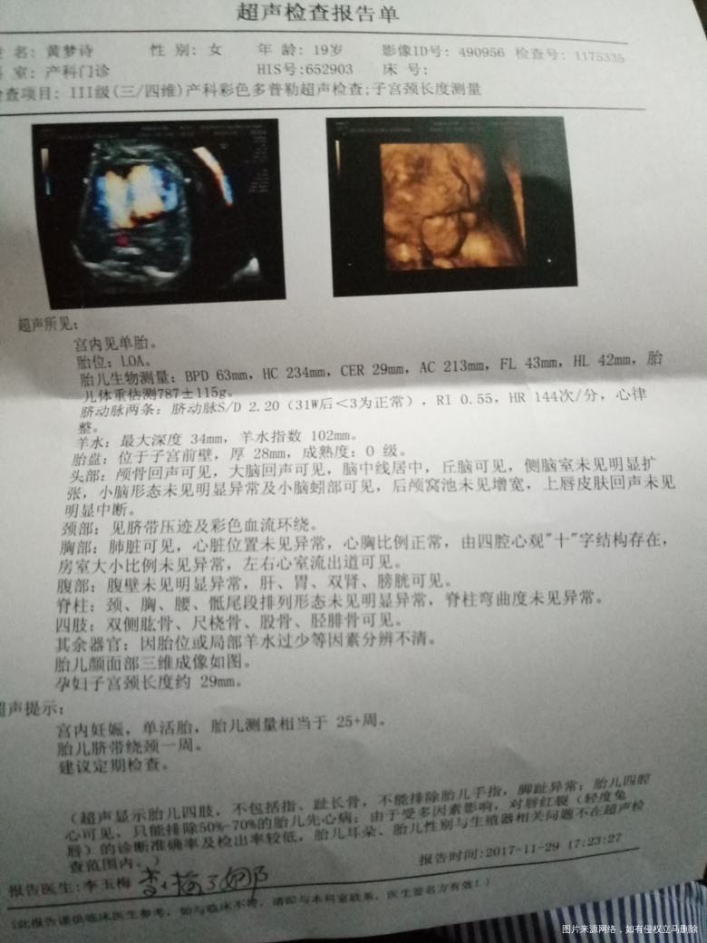 今天做了四维做完后医生已经下班了没来得及问