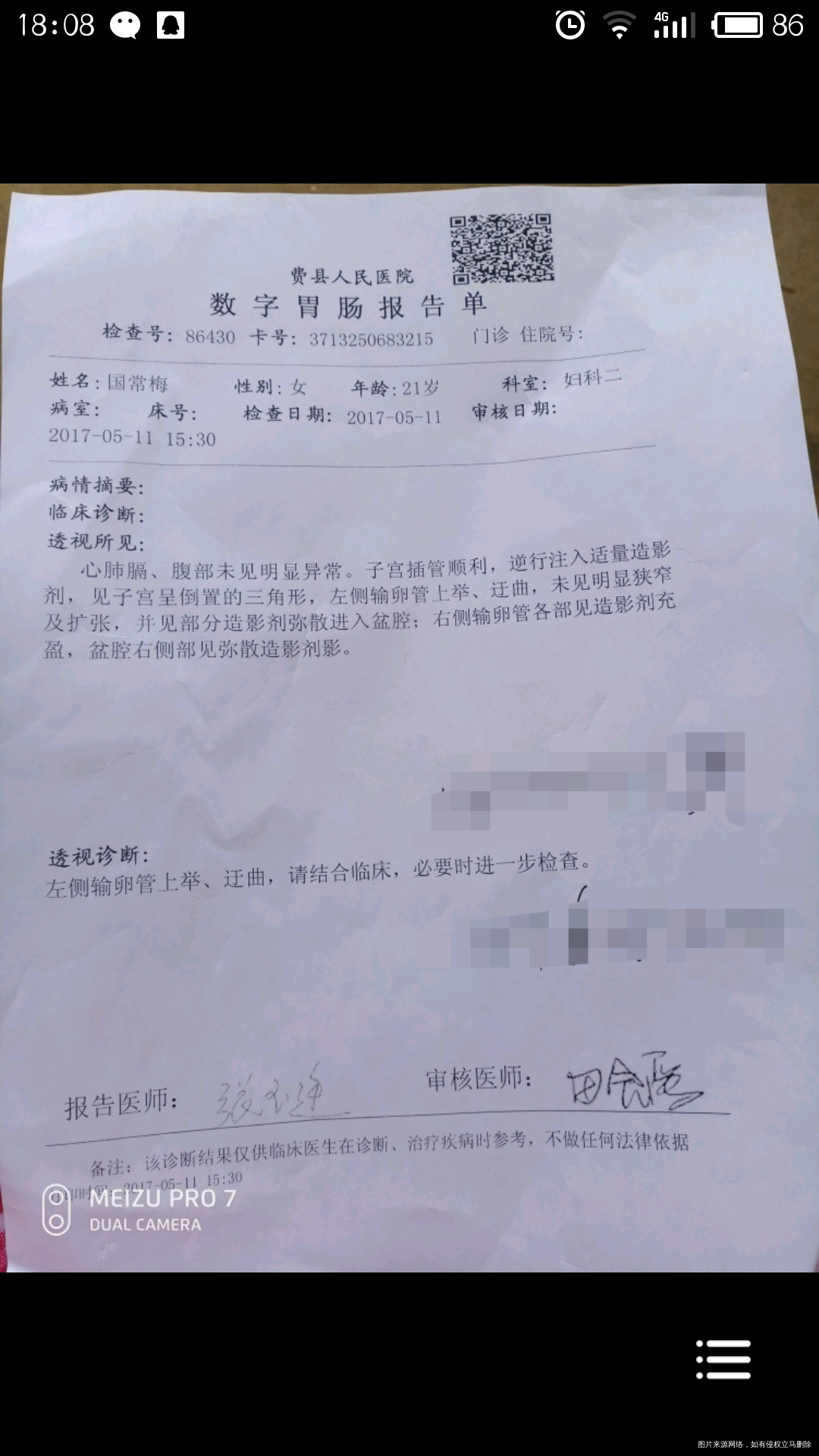 做的输卵管造影,请问有什么问题嘛?可以要宝宝了嘛?