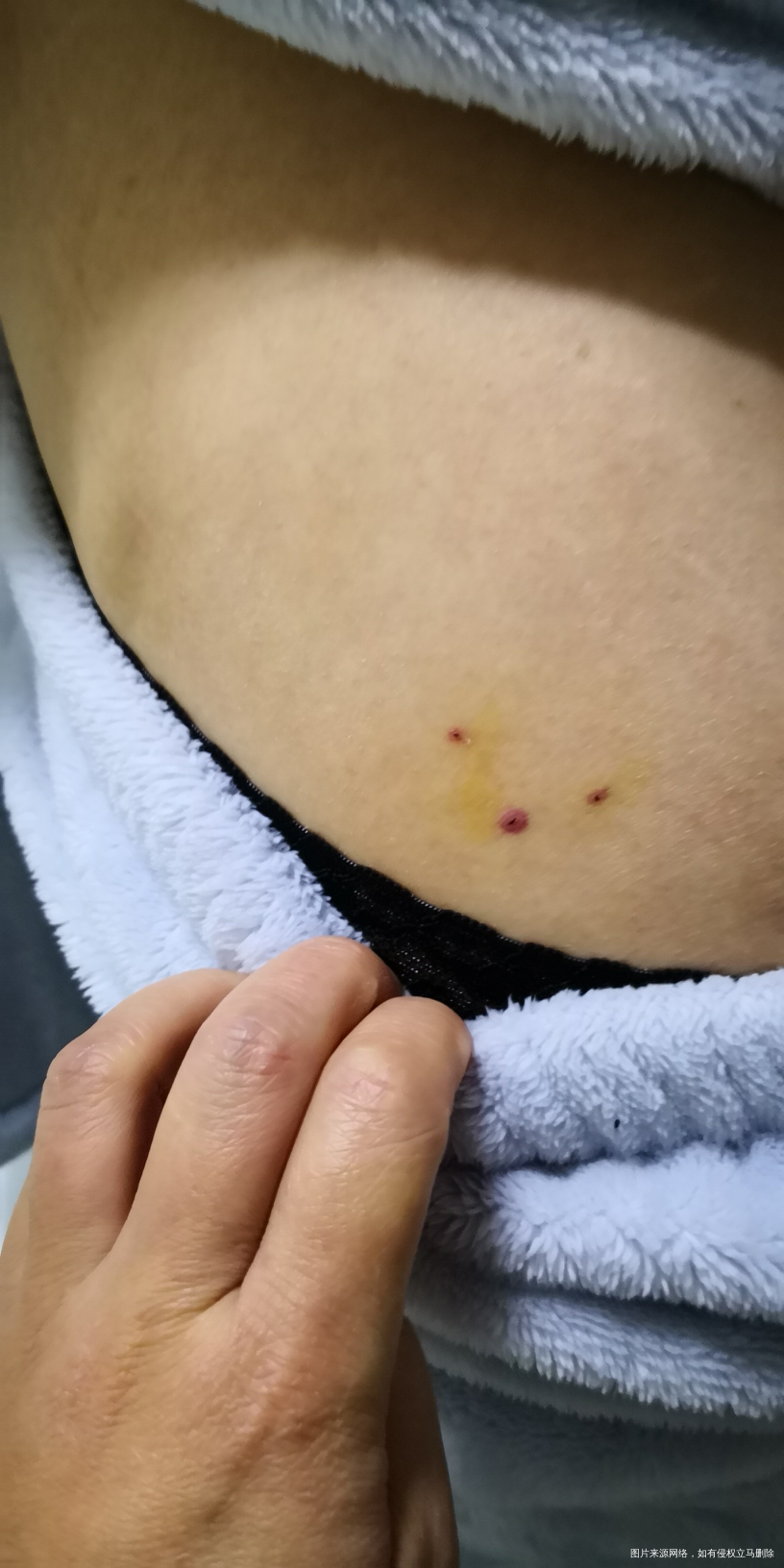 移植第5天了,发现凝血功能不好,会影响成功吗?