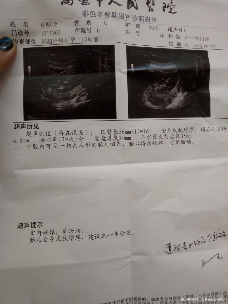 有医生在吗?帮我看看,我该怎么办