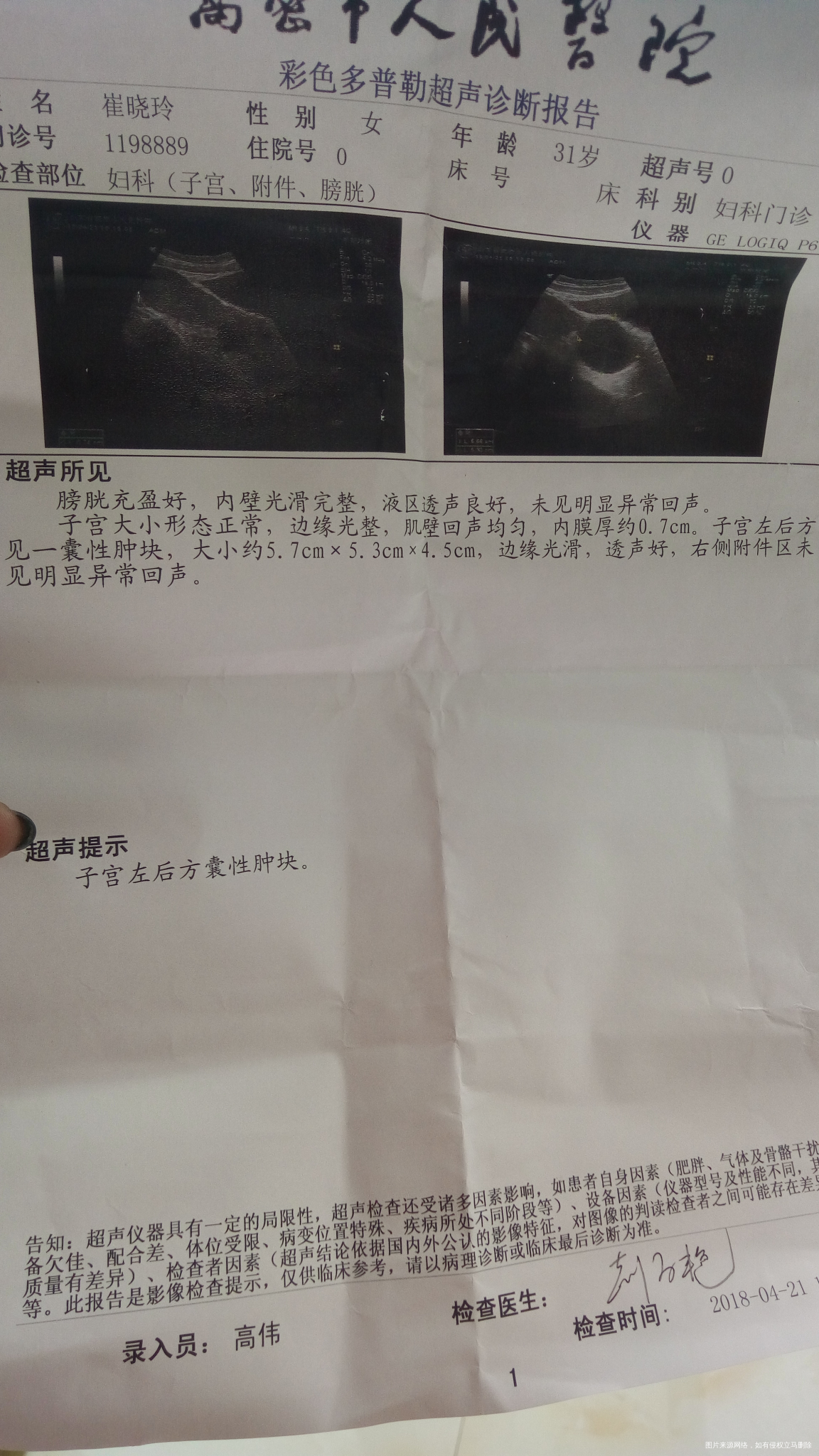 急医生帮我看看今天做的B超,怎么办