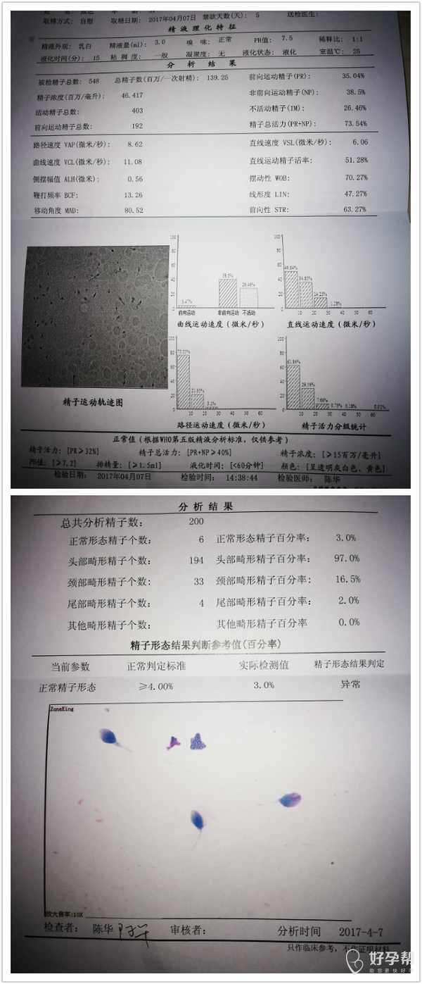 精子形态只有3%,问题大么?该怎么办?