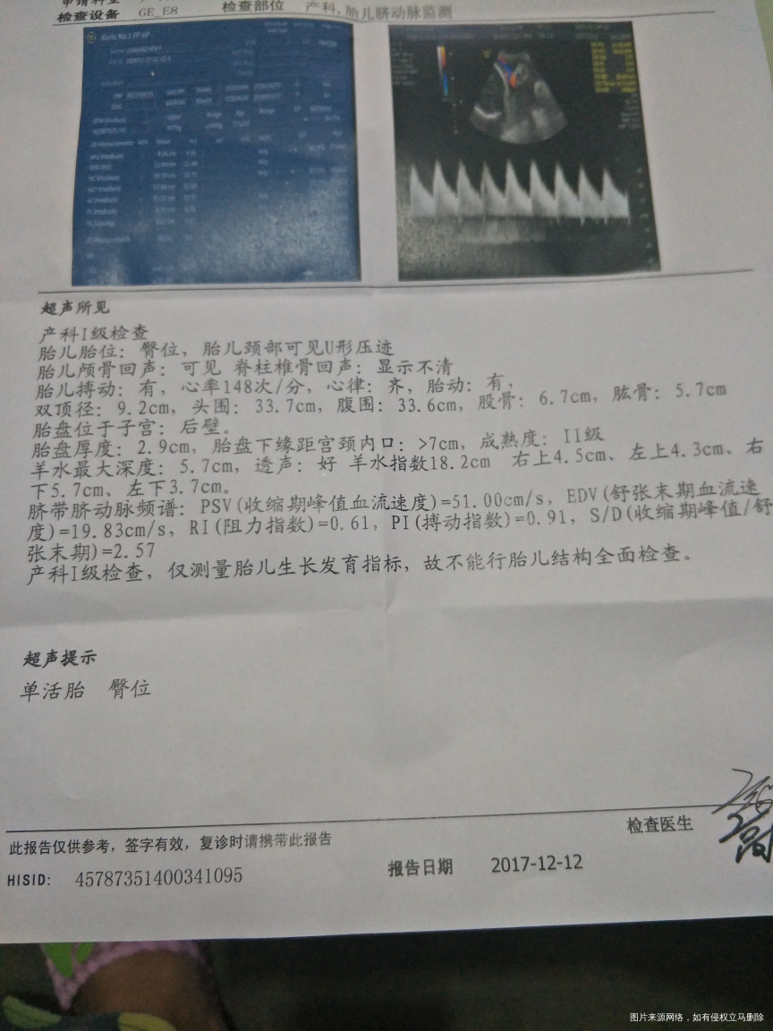 谁能帮帮忙看看吖!俄想顺产呢