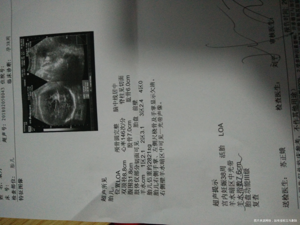 急,急,急,麻烦医生看一下,正常吗