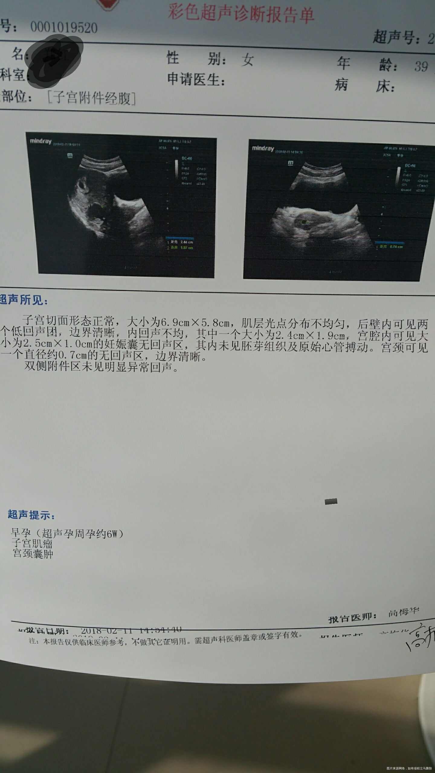 末次12月25,怎么办?二胎