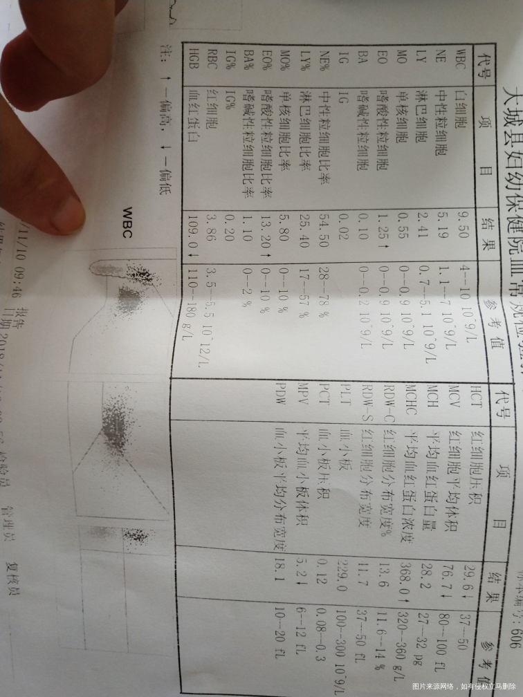 请问医生我这贫血厉害吗?需要喝药吗?