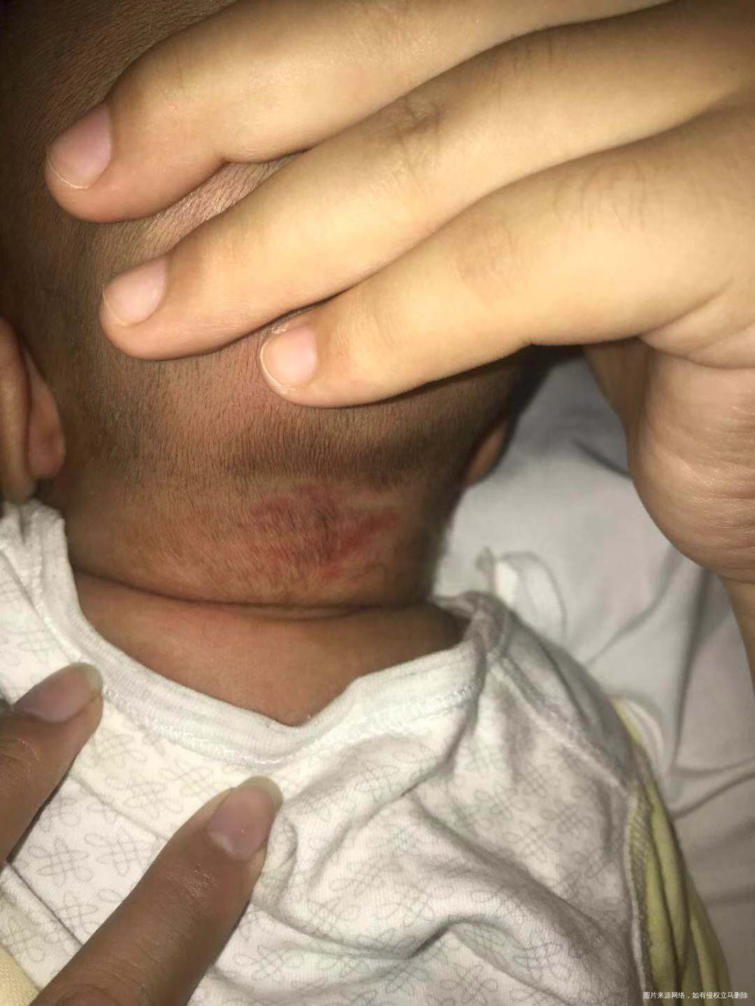 麻烦医生给看看是什么,宝宝50天