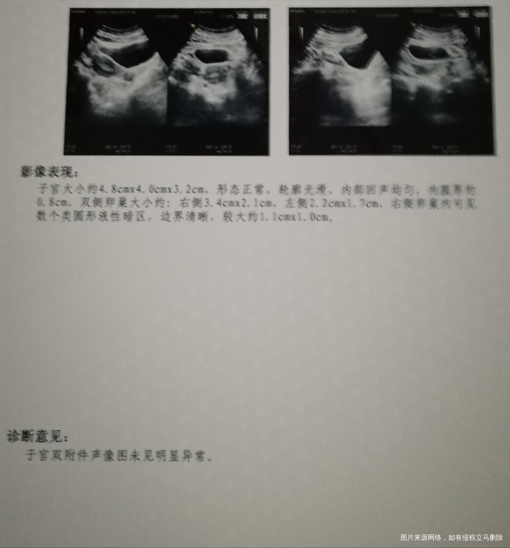 数个类圆形液性暗区是啥,是有很多卵泡吗,还有,左边卵巢是不是小,没影响吧?