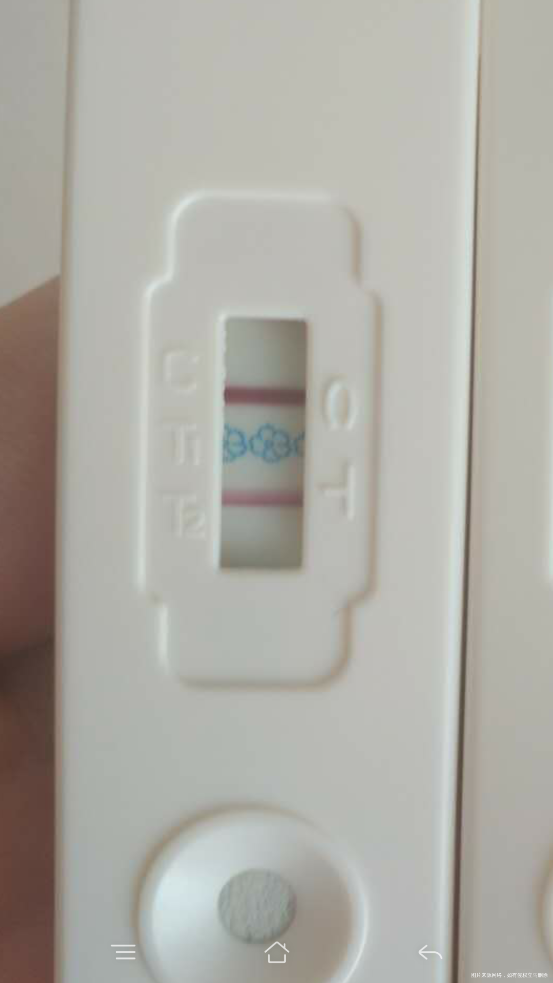 囊胚移植十三天测出好孕但是腹泻应该怎么办