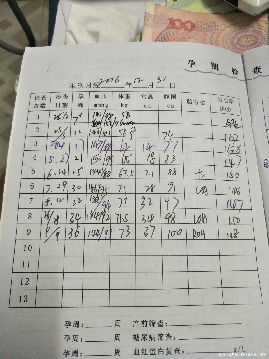 血压高,昨天产检医生叫下周住院