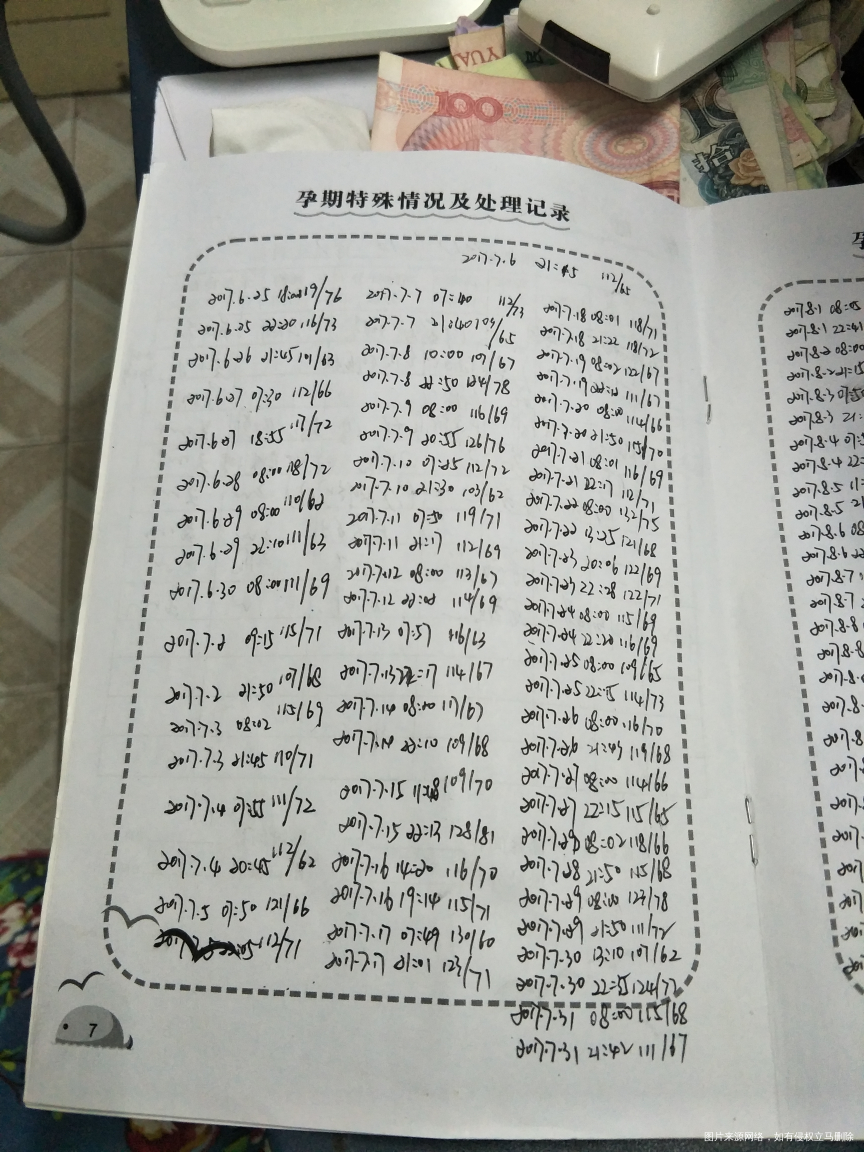 血压高,昨天产检医生叫下周住院