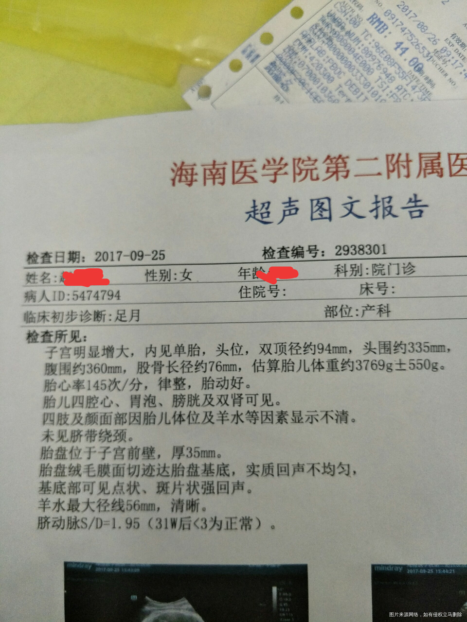 请帮我看看宝宝有多重了,能顺产吗?
