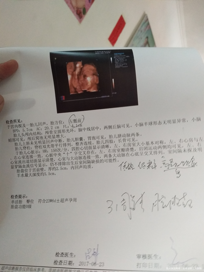 急急急bc单子越看越不准半月前查的和今天长了两天??