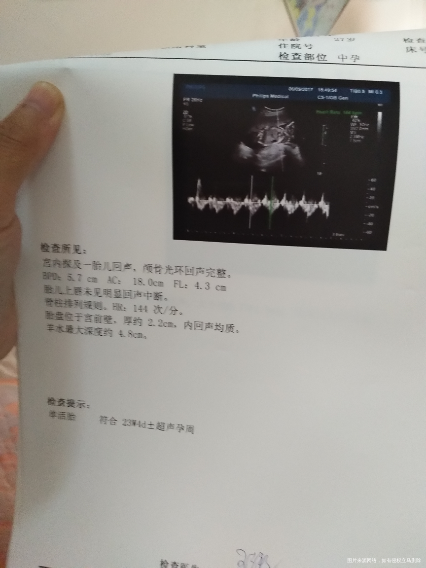 急急急bc单子越看越不准半月前查的和今天长了两天??