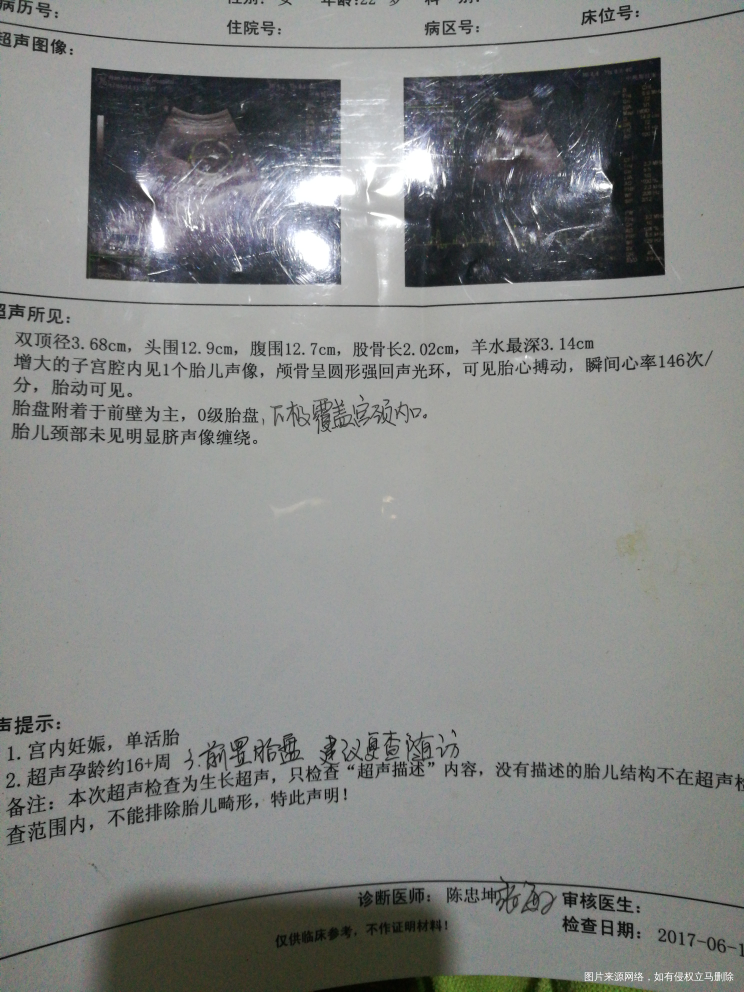 怀孕16+5周,今天去做的彩超,医生说。。。。。