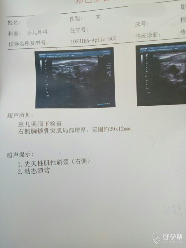 三个月宝宝,斜颈,还有髋骨节发育