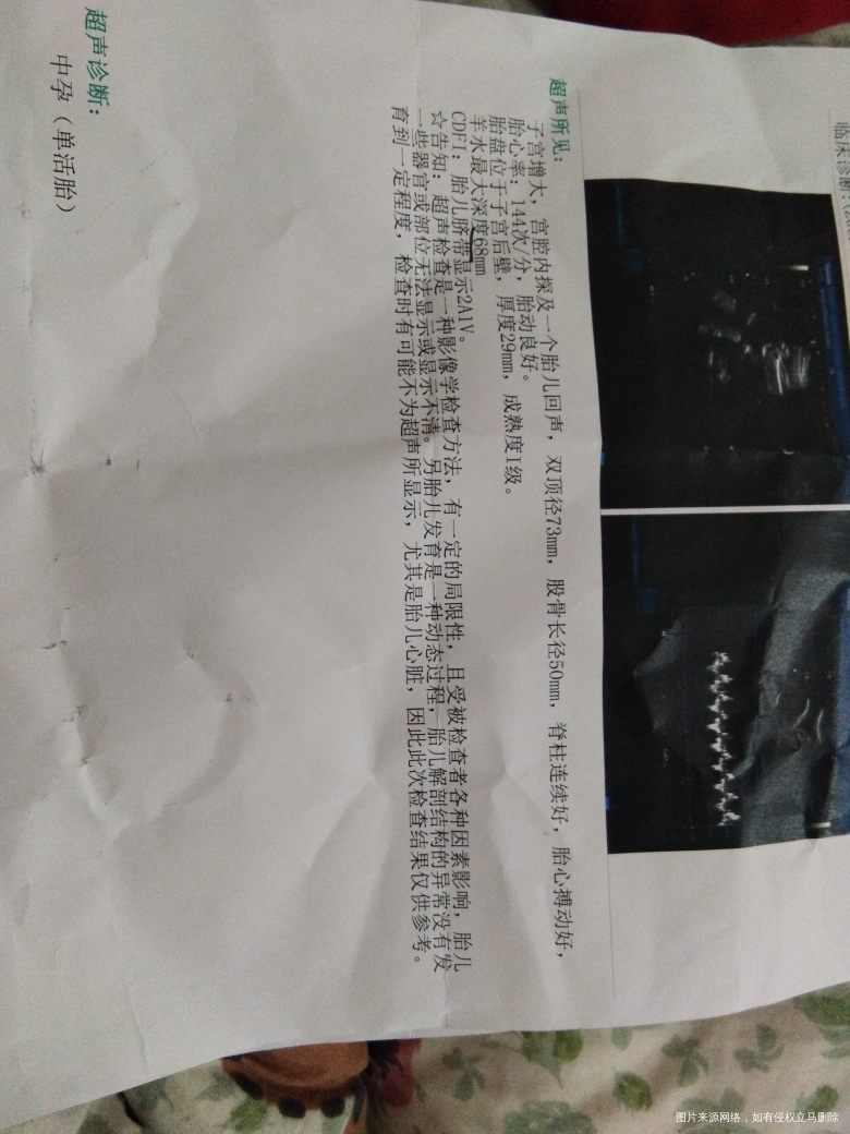 麻烦医生帮忙看看这样正常吗