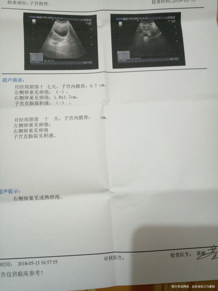 医生帮忙看看可以同房了吗?排卵试纸还没强阳