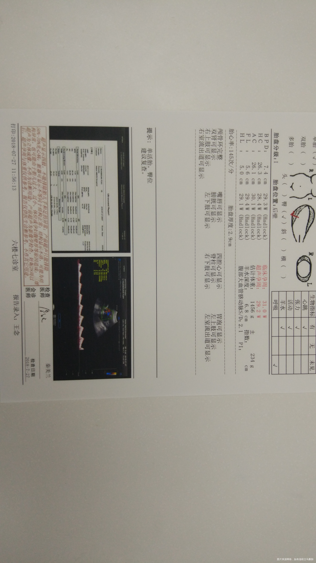 请医生帮忙看看小排畸的结果