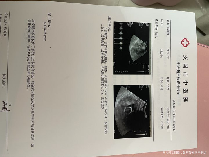 怀孕三个月同房后有点流血