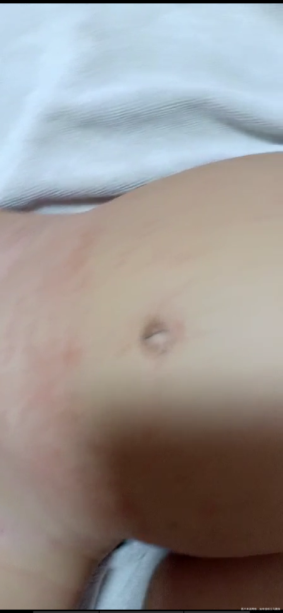 医生帮我看看宝宝这是怎么了?