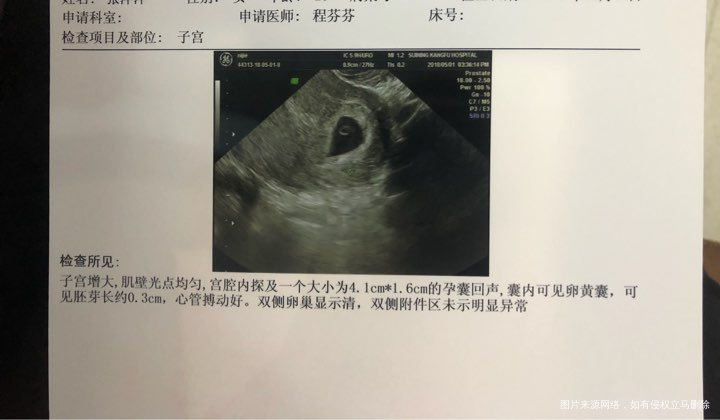 
43天 不想吃饭 没食欲 就吃点水果 有同样反应的宝妈吗