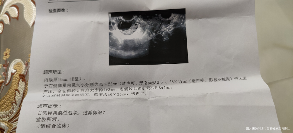 这个结果单有正常卵泡吗![/storag