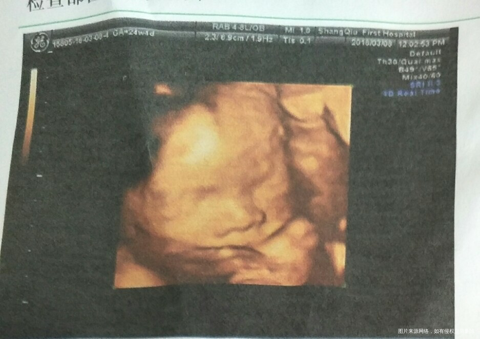 医生帮忙看看这个四维图