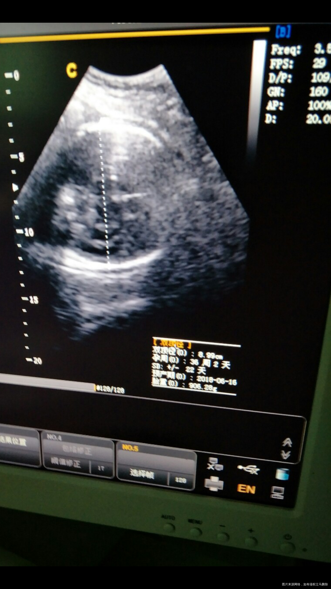 医生帮忙看下这个几个数据是什么意思