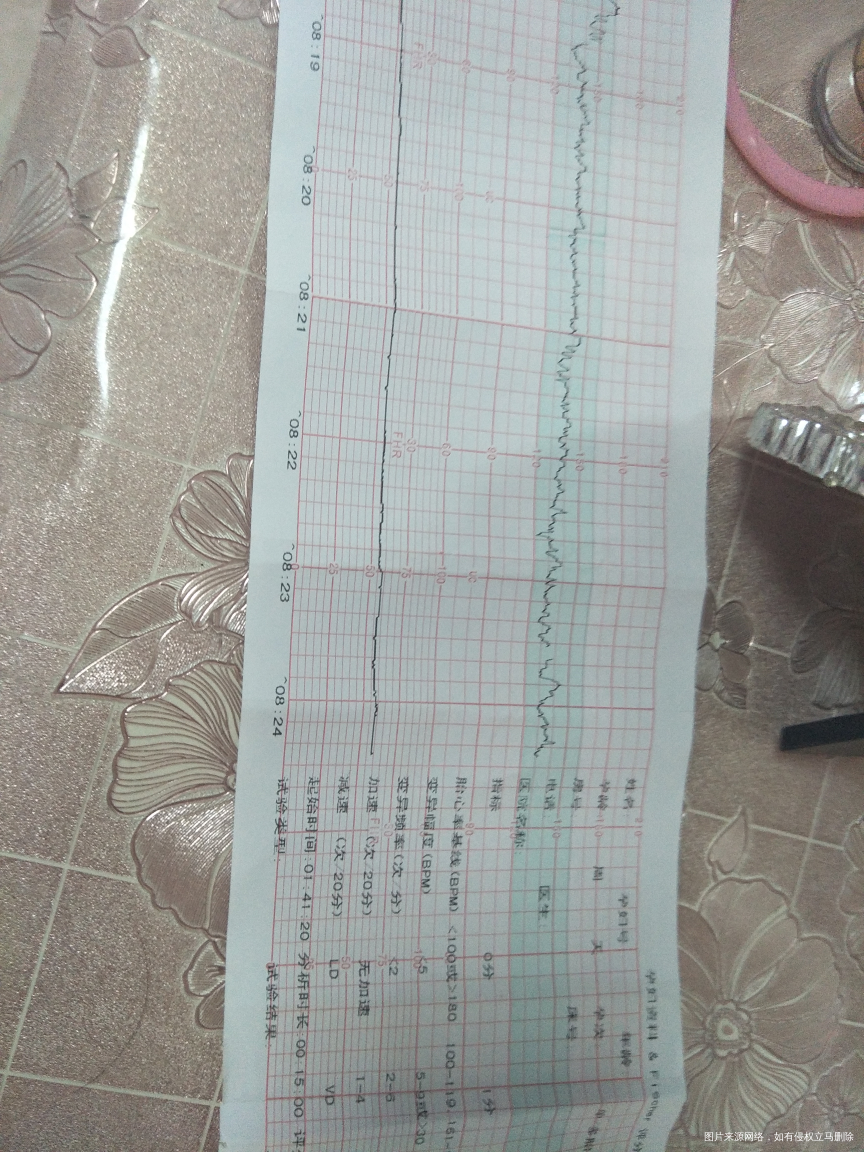 医生帮看看今天的胎心监护过了吗