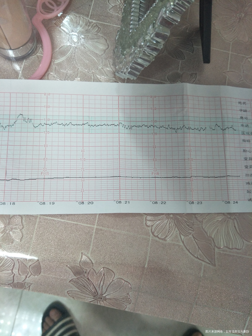 医生帮看看今天的胎心监护过了吗
