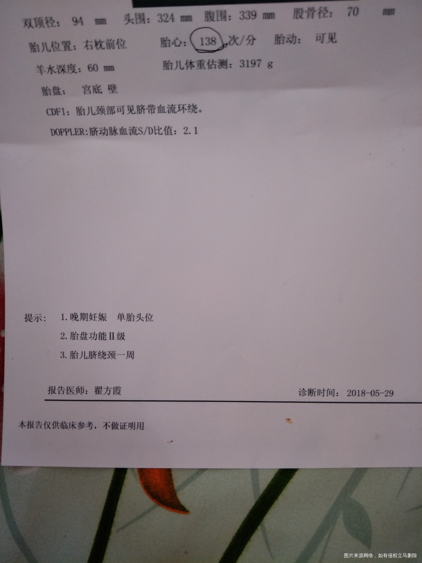 医生帮我看下彩超单子上面有脐带绕颈一周