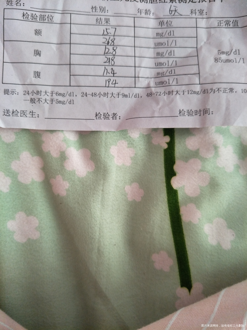 医生帮忙看看新生儿黄疸值,看看宝宝脸黄吗