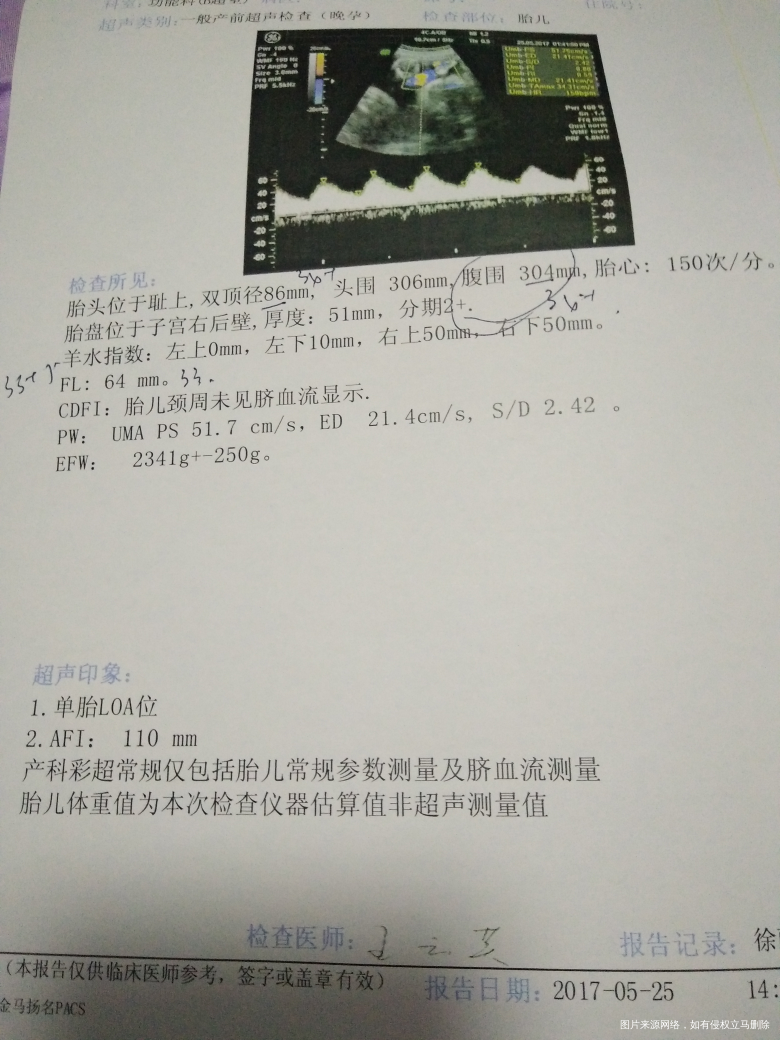 医生说宝宝好像大了点