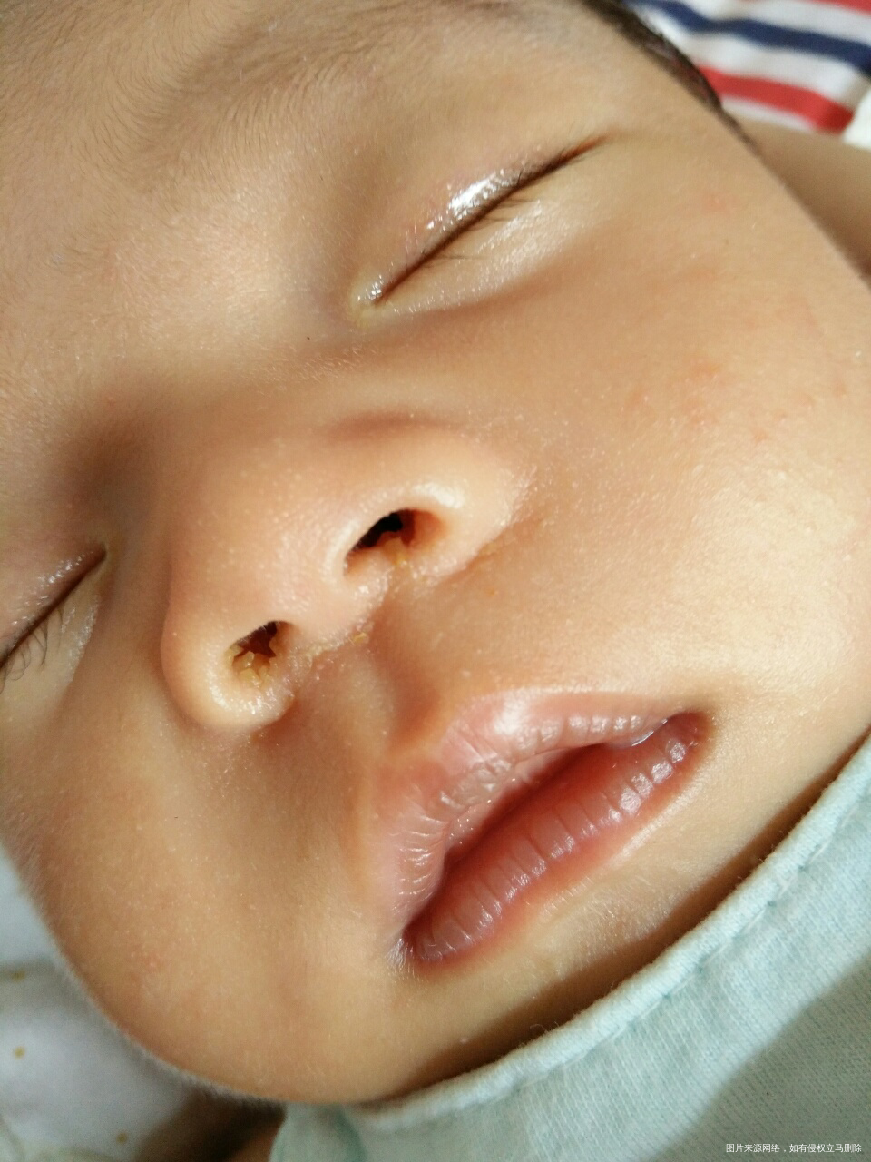 宝宝出生27天,刚刚发现宝宝