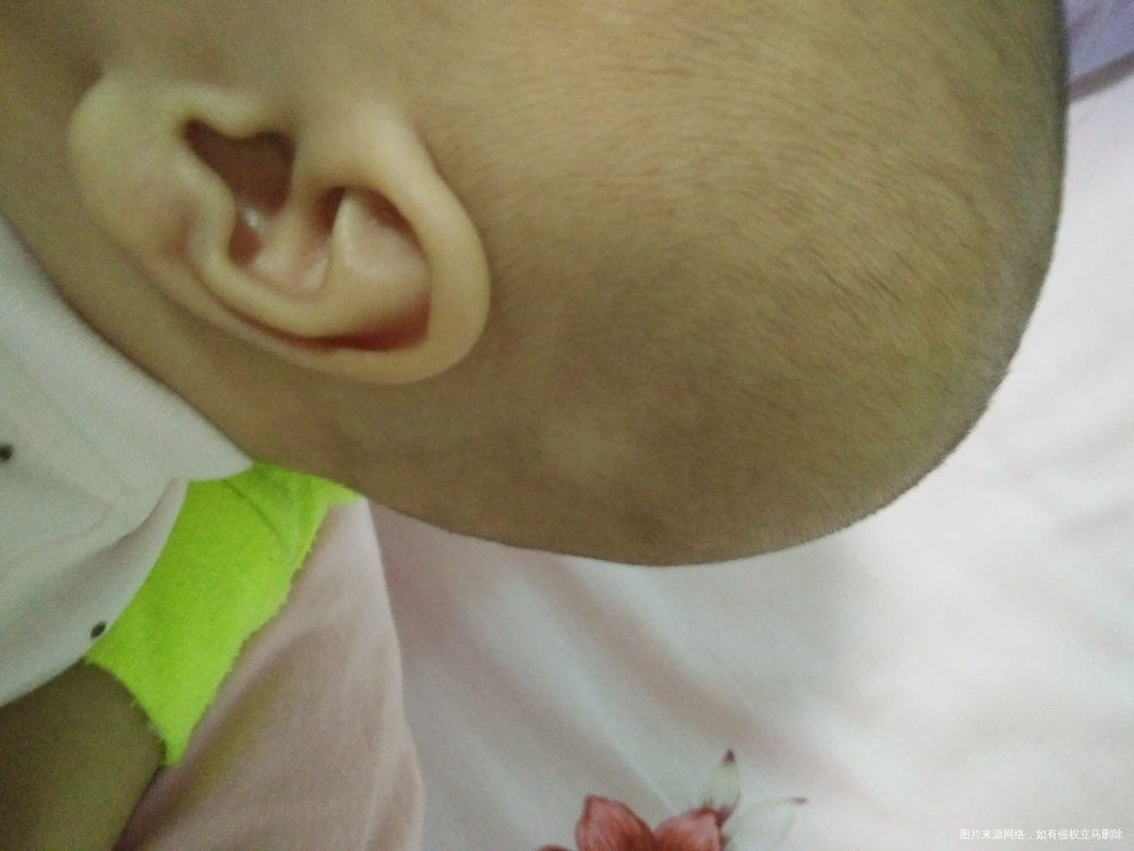 宝宝三个月,头发满月时剃的,到现在都没