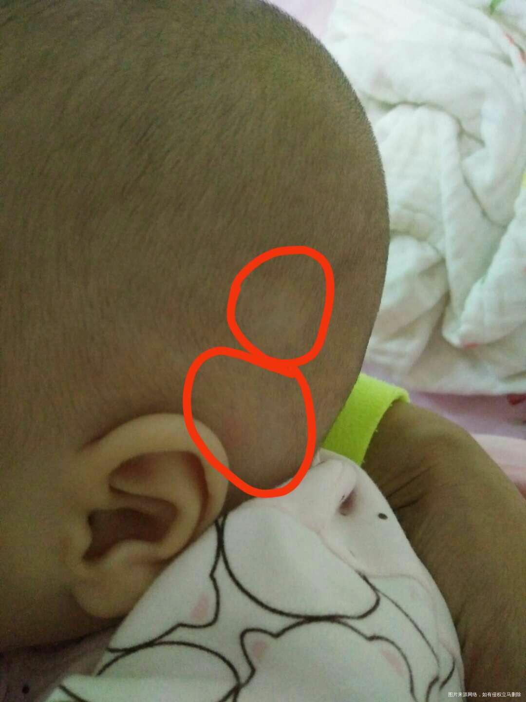 宝宝三个月,头发满月时剃的,到现在都没