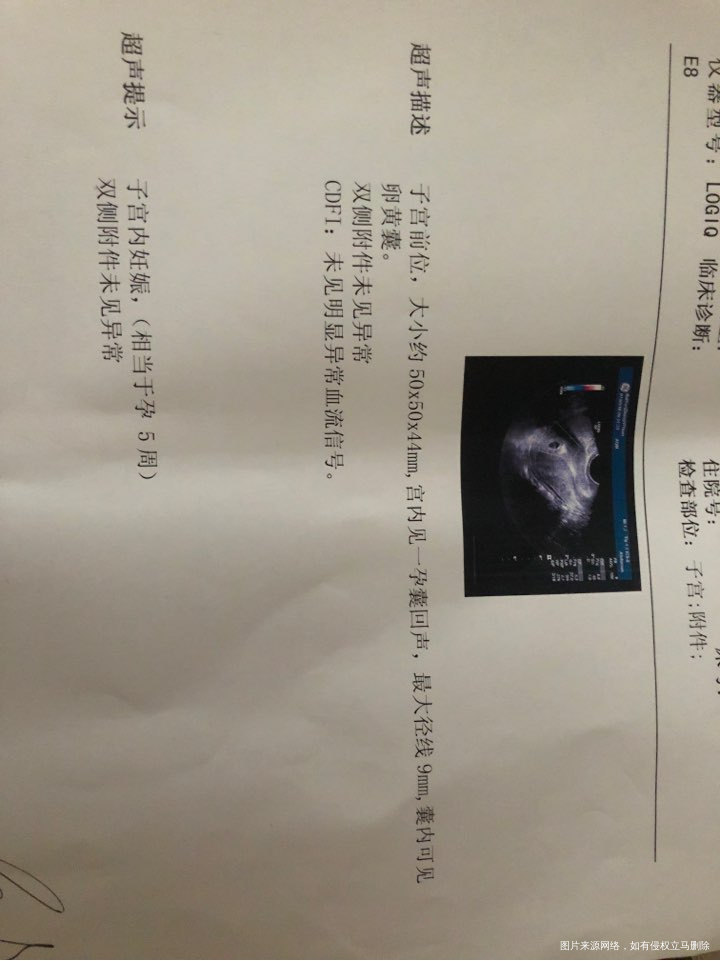 末次月经是5月23.应该有6周了,怎么是5周?正常吗?