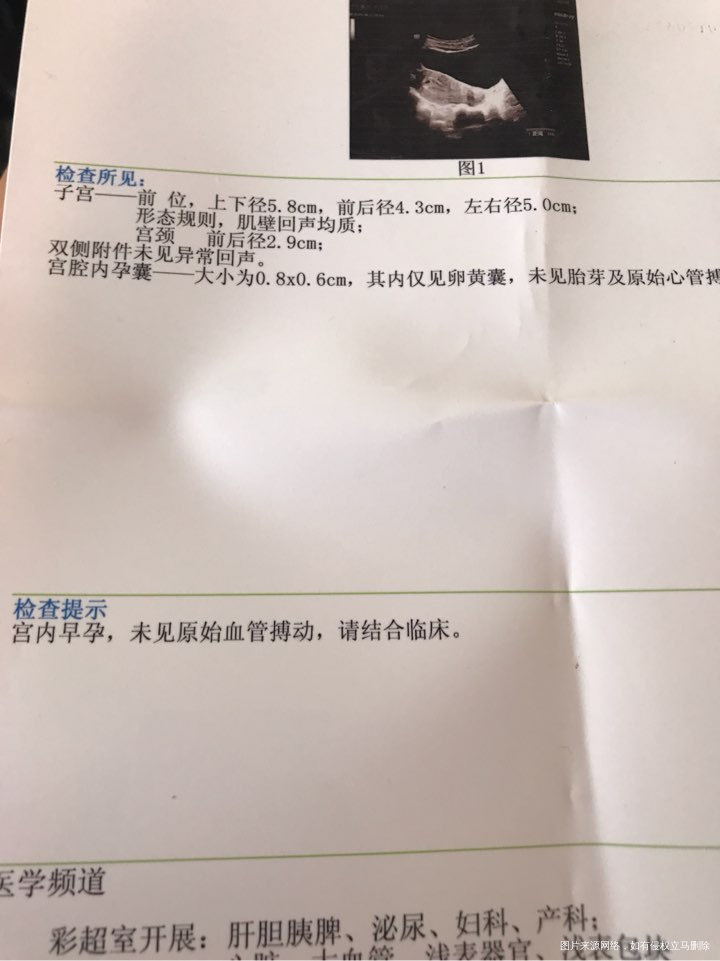 请大家帮忙看下,麻烦大家了