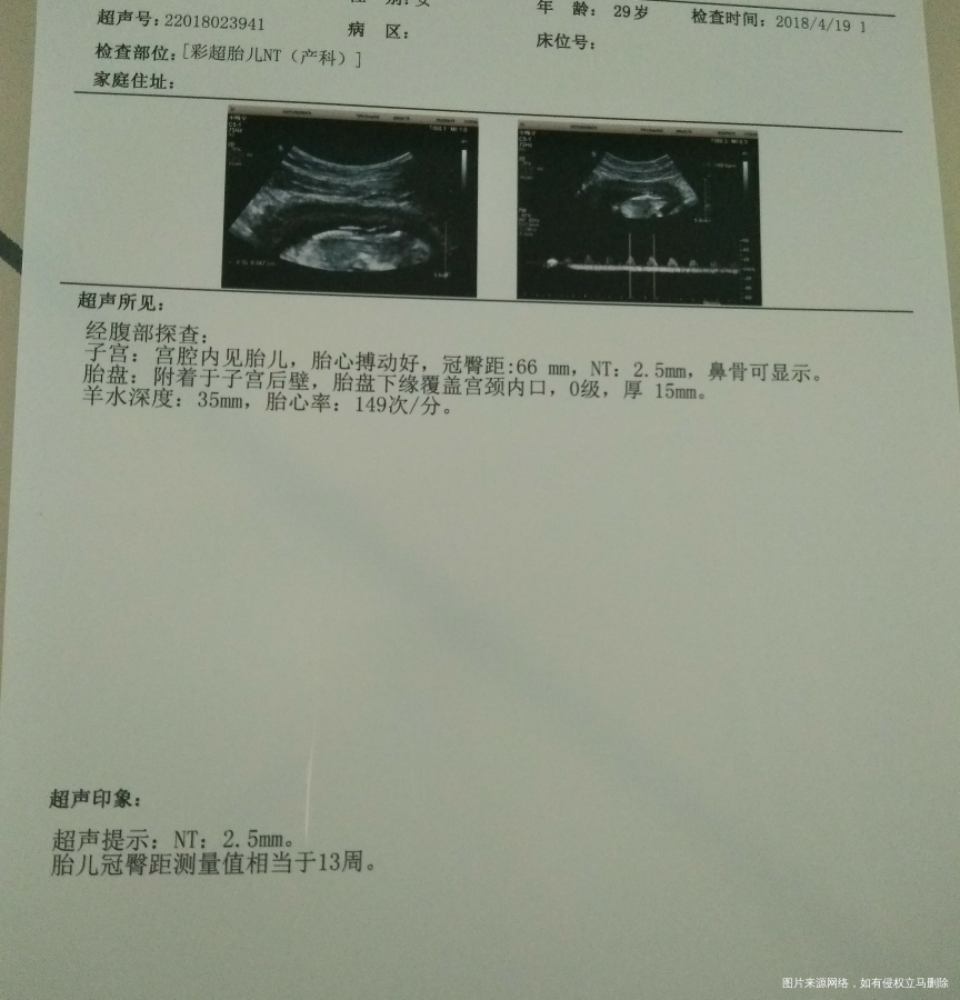 12W+1,NT值2.5mm,求助