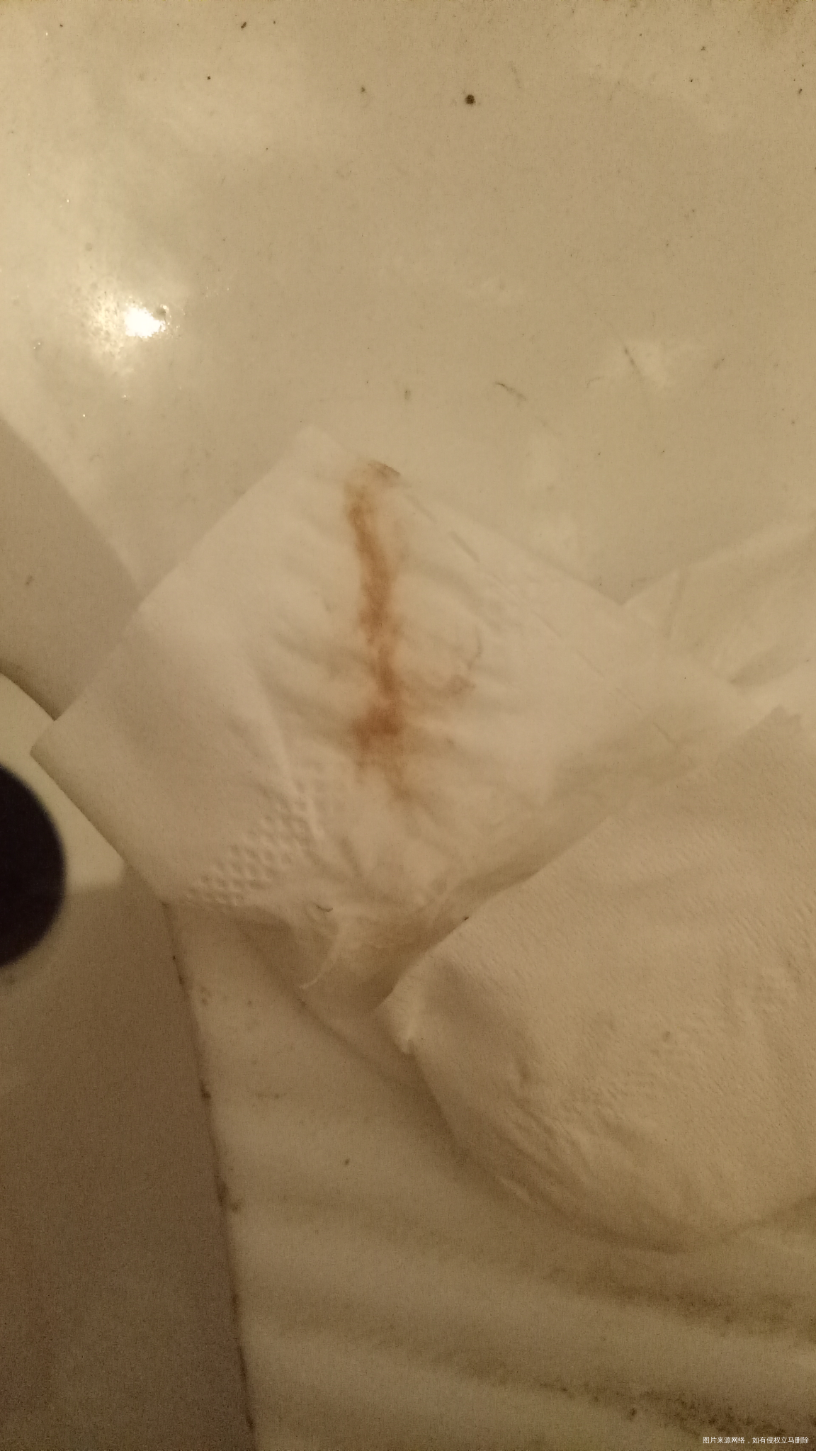 急,急急,这是要流产吗?😭