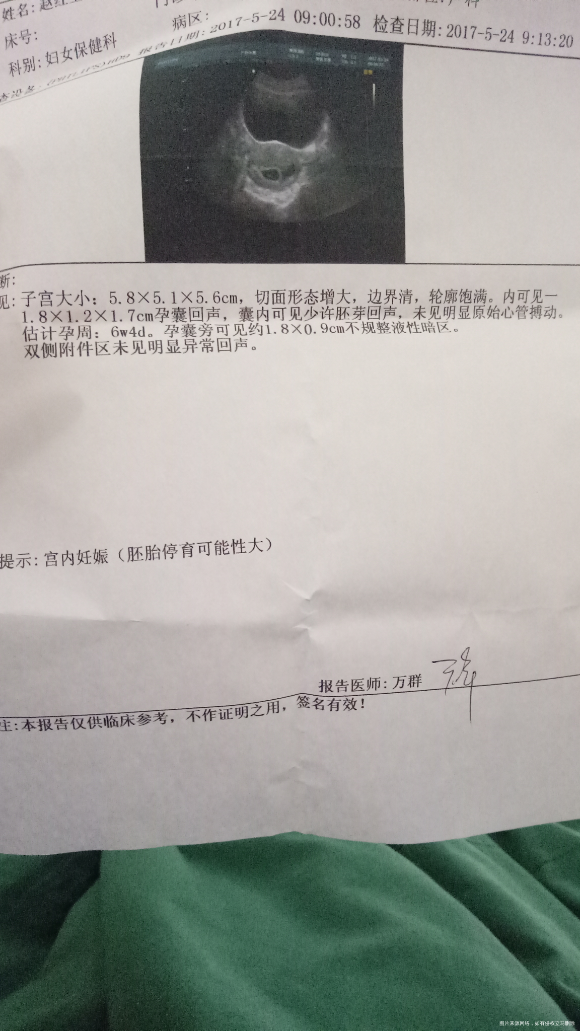 请医生辛苦帮忙看下孕囊大小,谢谢了