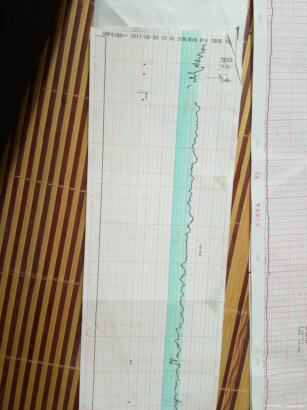 有没有胎心检测做好几次才过得宝妈