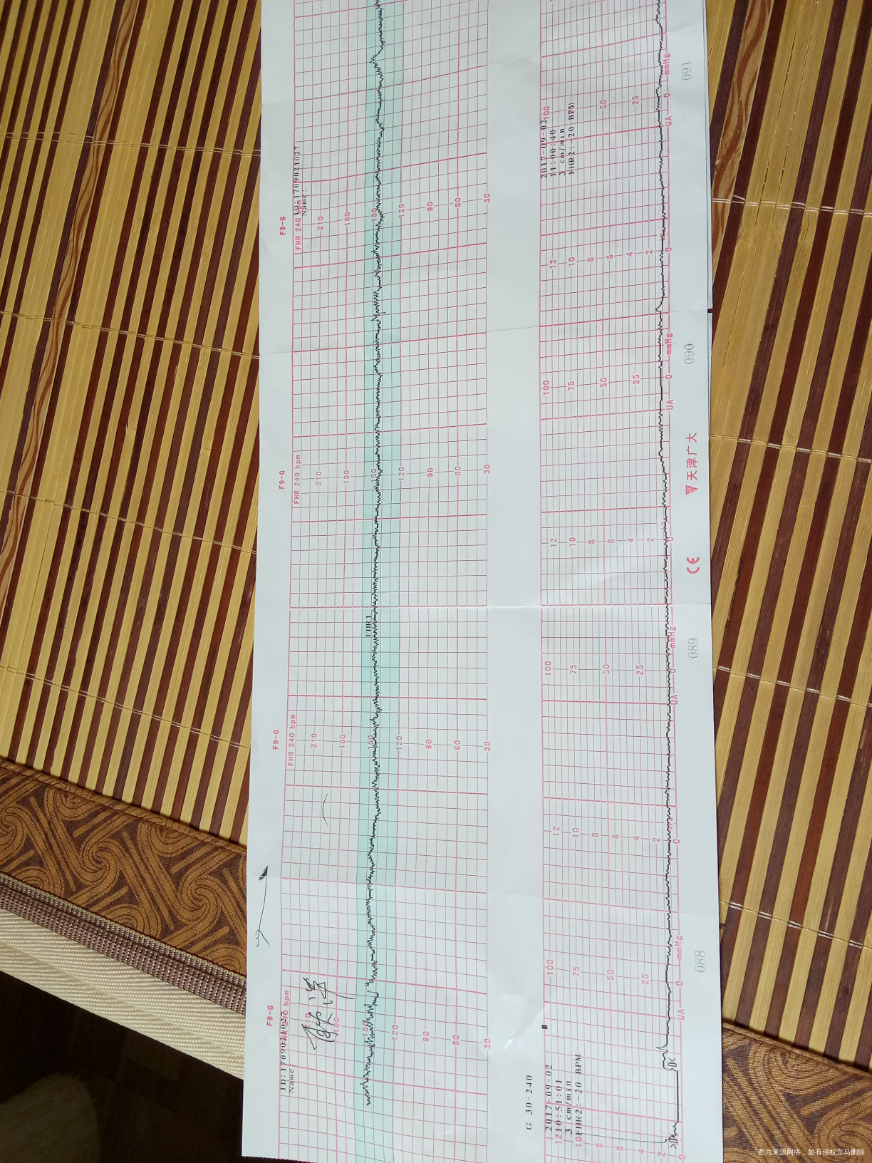 有没有胎心检测做好几次才过得宝妈