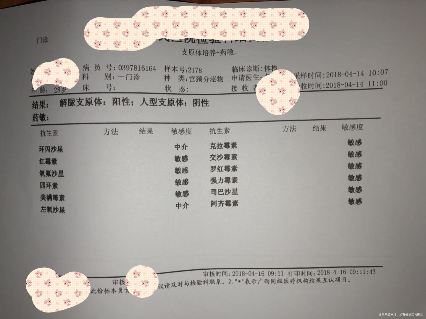 白带报告,请医生帮忙看一下对备孕有什么影响吗?