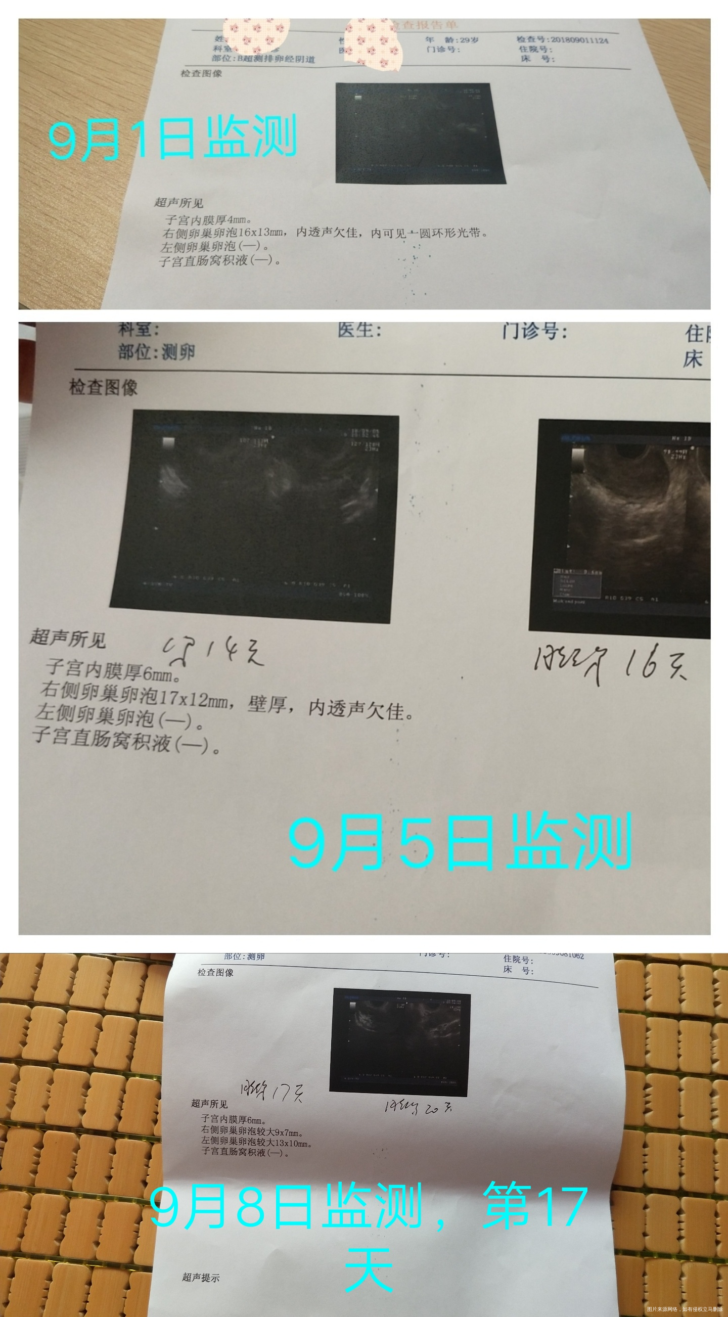 备孕备孕,求医生帮忙看一下排卵监测报告并做解释