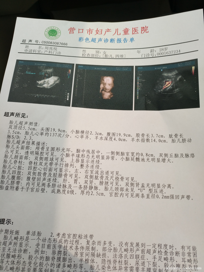 求助医生帮忙看看,一侧脑室0.8正常吗