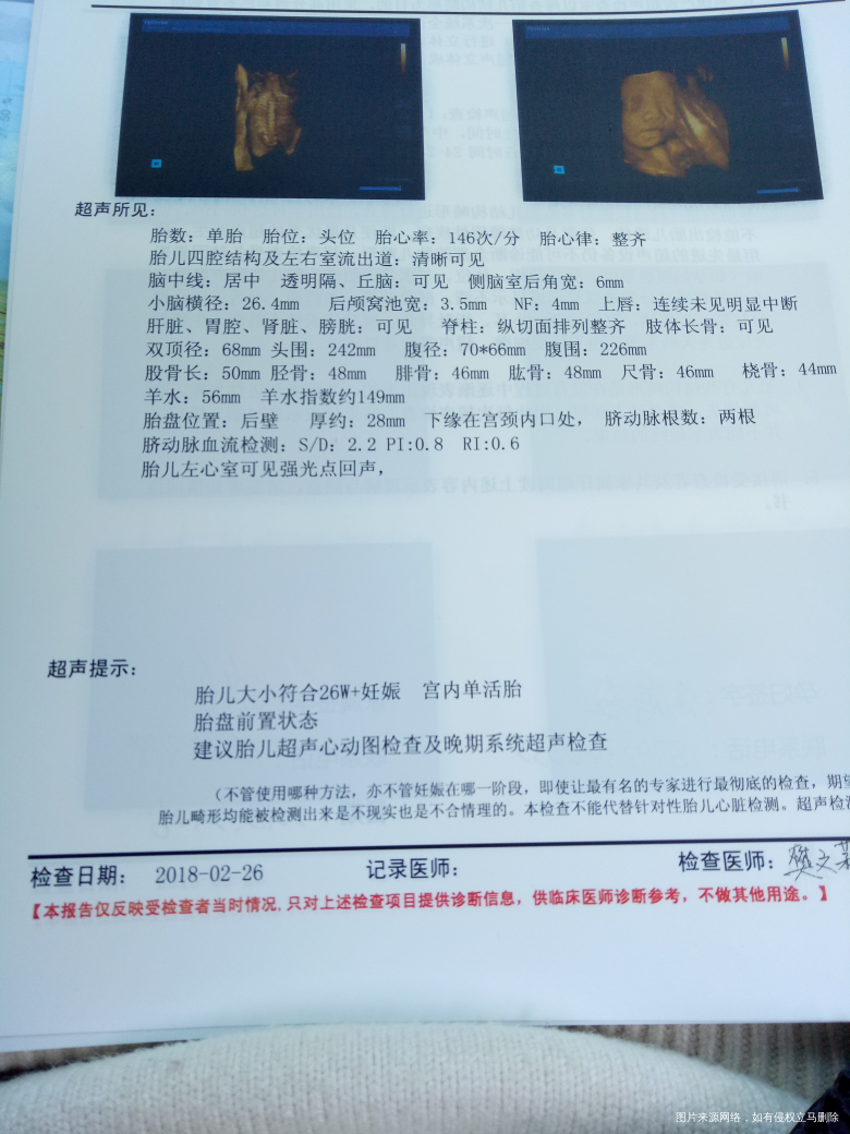 四维显示左心室有强光点回声要紧吗?