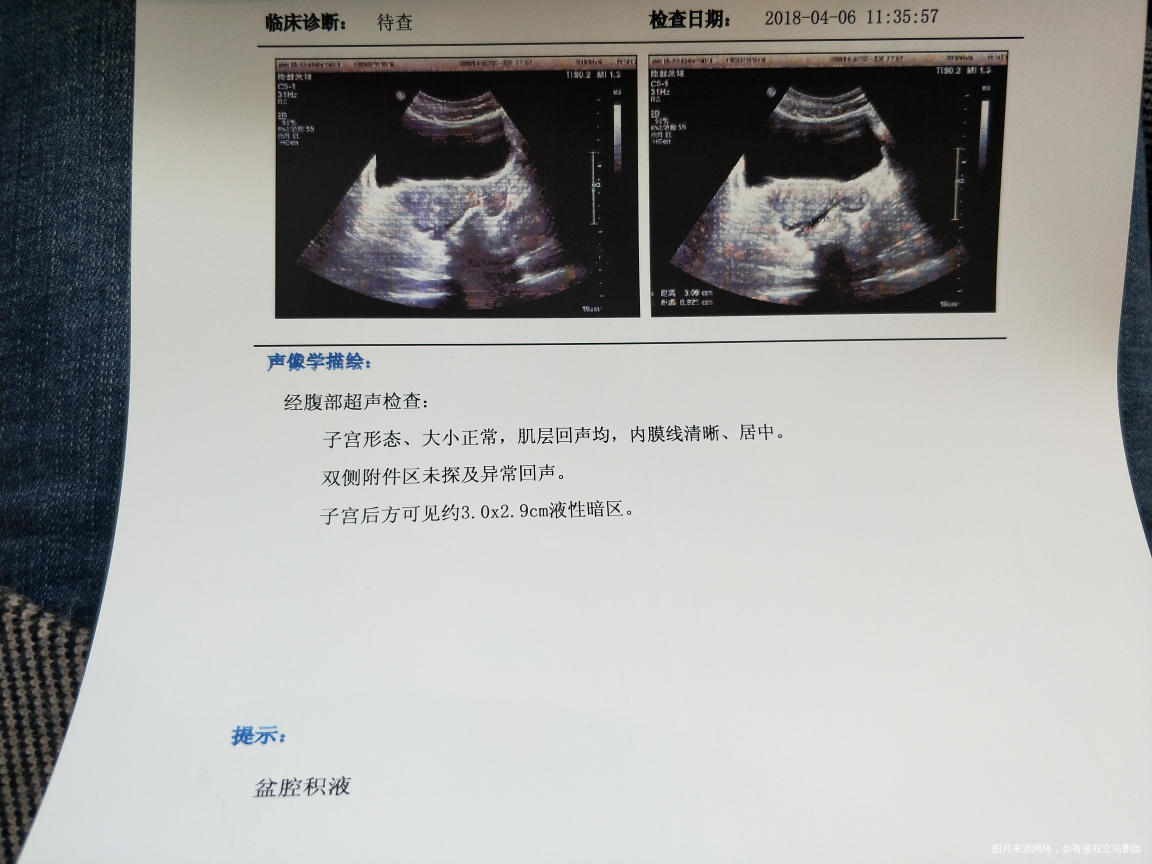 
血检测出怀孕 b超还显不出来但是有点盆腔积液 对宝宝有影响吗…